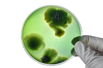 Hand with Petri dish or culture media with bacteria on white background with clipping, Test various...