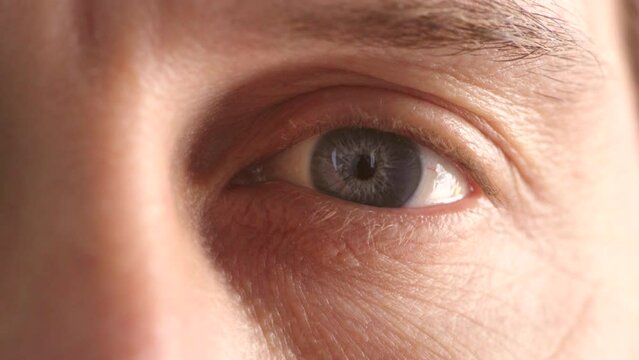 Man with blue eye blinking nervously. He might be uneasy as he is taking an eye exam and is scared he might fail. His pupil is small and black perhaps due to a bright light that shocked him.