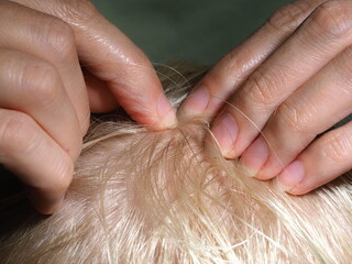 Finding and removing lice from the hair of a child's head