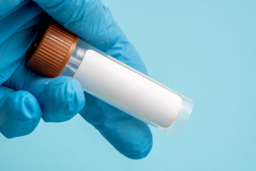 Test tube with a blood sample for laboratory analysis with a blank sticker without text