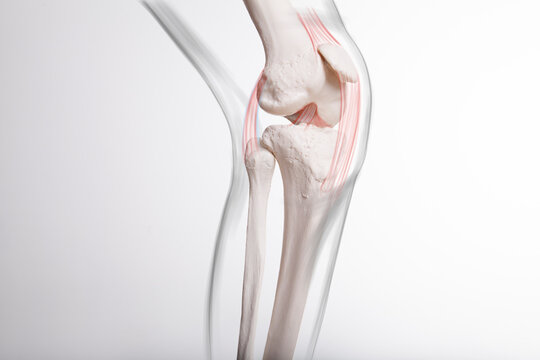 Human leg,  knee meniscus, medically accurate representation of an arthritic knee joint