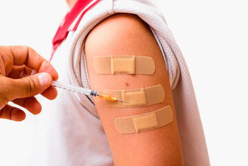 Poor recently vaccinated child with three band aids to feel good.