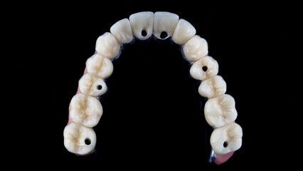 dental morphology of teeth on the prosthesis of the upper jaw, top view on a black background © Dental Pro Content