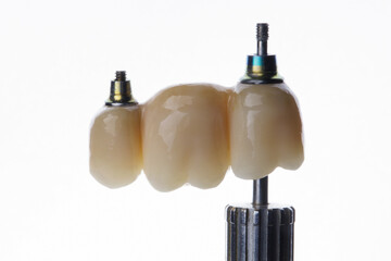 dental bridge prosthesis from zircon with bolts on a screwdriver with a white background