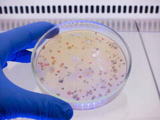 An open petri dish with different colonies of bacteria in a sterile laminar box, a person's hand...