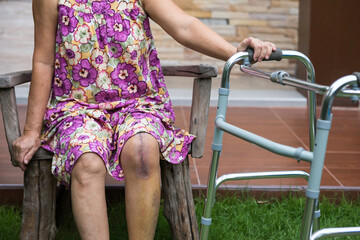Old woman after knee joint surgery hold walking frame
