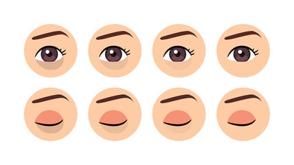 Dark Circles Under the Eye. Female Open and Closed Eye. Treatment of Peribital Circles. Before After. Healthy Skin. Color Cartoon style. White background. Vector image for Medical and Beauty design.