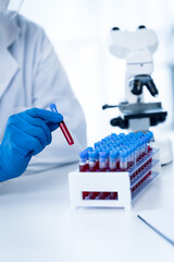 Doctor hand taking a blood sample tube from a rack with machines of analysis in the lab background,...
