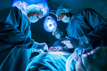 Team of surgeon doctors are performing heart surgery operation for patient from organ donor to save more life in emergency surgical room - obrazy, fototapety, plakaty