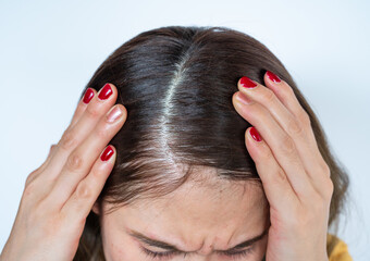 Fototapeta premium Close up of Asian woman worrying about her forehead with part of her thin hair, she had hair loss problem.