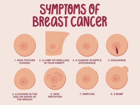 Breast cancer awareness month, medical Infograph illustration with breast cancer symptoms, for disease prevention campaign, flat vector illustration