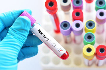 Blood sample tube positive with Marburg virus