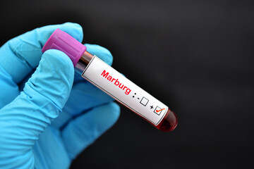 Blood sample tube positive with Marburg virus