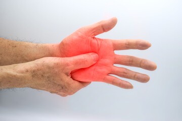 Painful palm of Asian man. Concept of compartment syndrome, cellulitis and hand muscles pain.