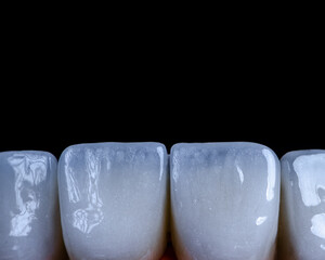laboratory prepared zirconium teeth
