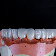 laboratory prepared zirconium teeth