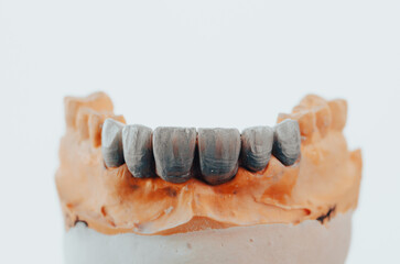 laboratory prepared zirconium teeth