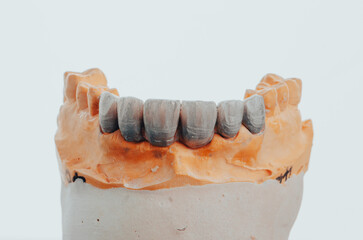 laboratory prepared zirconium teeth