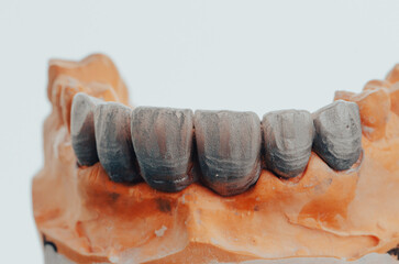 laboratory prepared zirconium teeth