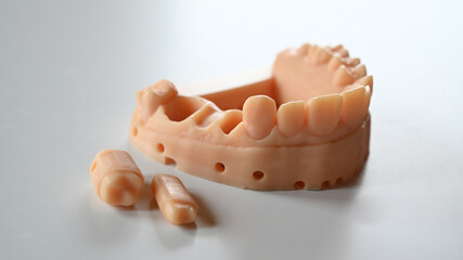 Model jaw dental teeth. Dentistry and dental Technicians. 