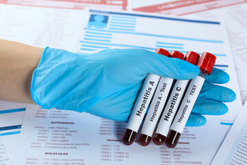 Scientist holding tubes with blood samples for hepatitis virus test against laboratory forms,...