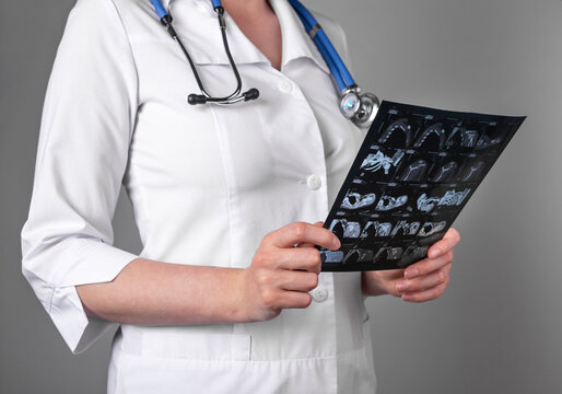 Doctor studying CT or MRI scan results. Diagnostics conducting for detecting diseases or injuries. Woman analyzing images of patient internal organs. Health care, medicine concept. High quality photo