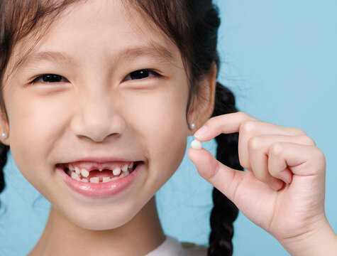 Asian child girl smiling with loose teeth, Dentistry and Health care concept
