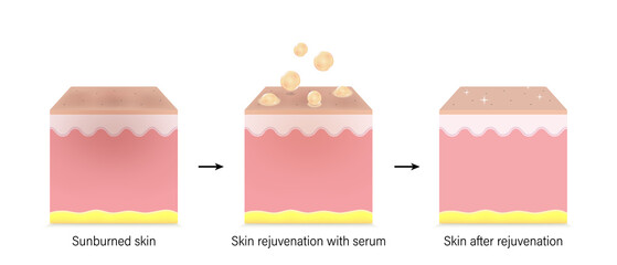 Skin layers before, during and after rejuvenation with skin serum. Skin care vitamins. Vector for advertising about beauty and medical treatment.