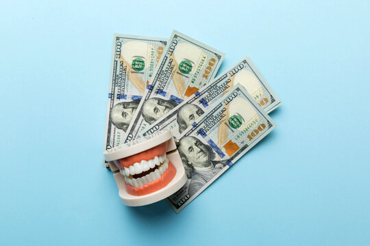 Closeup model of a human jaw with white teeth and dollar bill. Dentistry conceptual photo. Prosthetic dentistry. False teet top view with copy space