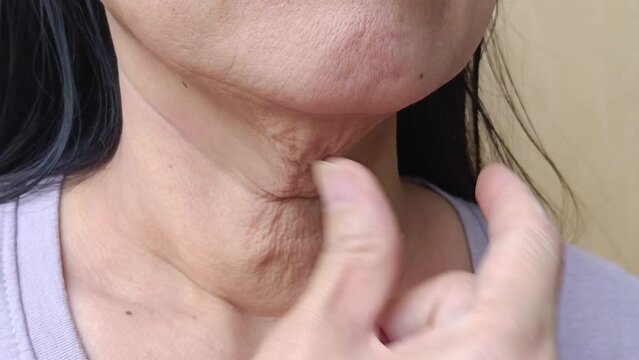 Woman pulling her finger on wrinkled skin on her neck.