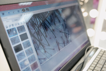 Diagnostic complex for microscopic examination of hair and skin of the scalp.