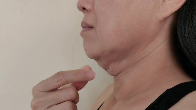 Portrait showing the fingers squeezing the flabbiness adipose sagging skin under the neck, wrinkles and flabby skin, problem cellulite and dark spots under the chin of the woman, concept health care.