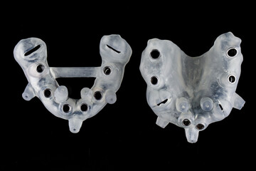 two surgical templates for total implantation of the upper and lower jaws on a black background