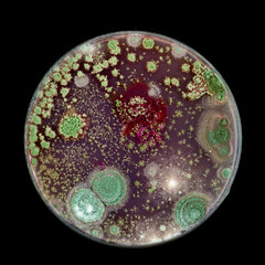 Samples of Petri dishes with a culture of microorganisms and fungi in the surface of agar nutrient...