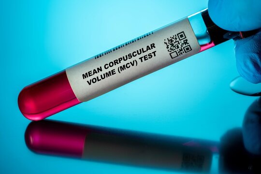 Mean Corpuscular Volume&nbsp;(Mcv) Test Blood Tests for Older Adults. Recommended Blood Test for the Elderly.