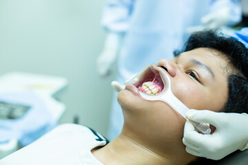 Asian teen opens mouth to dentist to check dental condition for treatment.