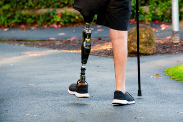 Man Walking with a Prosthetic Leg