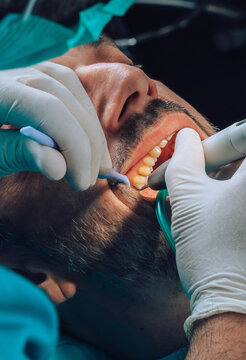 Detail during dental surgery with instruments and patient teeth
