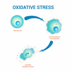 Oxidative stress diagram stock vector illustration design - obrazy, fototapety, plakaty