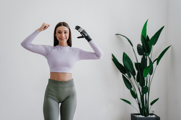 Young caucasian woman with disability standing  at home, with  bionic hand prosthesis, smiling,...
