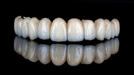 ceramic prosthesis without gums with a titanium bar for the upper jaw on black glass with reflection