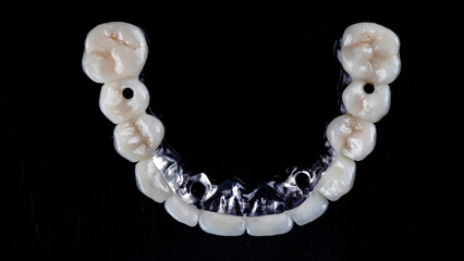 ceramic prosthesis of the upper jaw with a titanium beam on a black photo. view from above