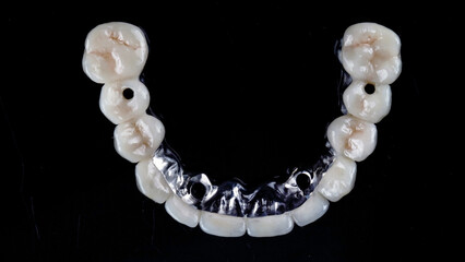 ceramic prosthesis of the upper jaw with a titanium beam on a black photo. view from above © Dental Pro Content