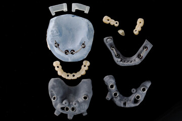 top view of a surgical dental template with dental templates for implantation and prostheses on a...