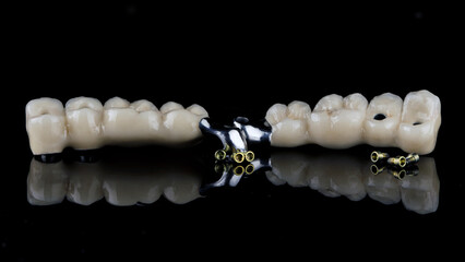 two dental prosthesis bridges made of zircon and a titanium bar with orthopedic screws on black glass with reflection