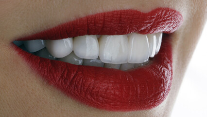 beautiful smile of a girl with veneers and red lips on a white background