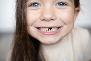Close-up A cute funny blue-eyed girl without a baby tooth. A toothless smile. A milk tooth fell...