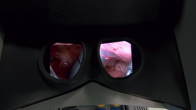 A PRECISION SURGERY MACHINE FROM DOCTOR POINT OF VIEW