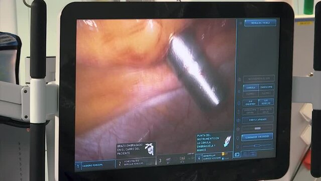 MONITORING A SURGICAL MACHINE OPERATING WITHIN THE HUMAN BODY