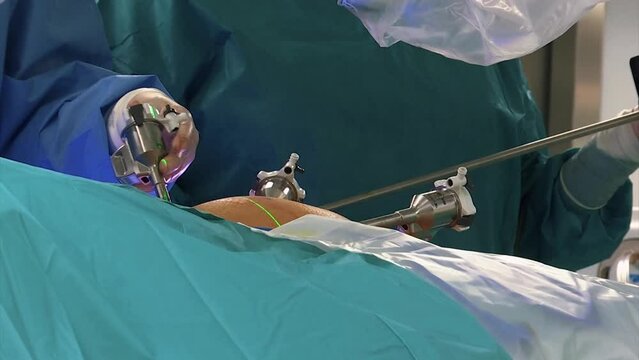 MEDICAL SURGICAL USING DEVICES DURING THE OPERATION